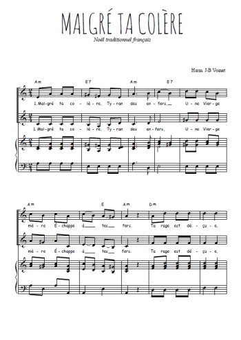 Téléchargez l'arrangement de la partition de Malgré ta colère en PDF pour deux voix égales et piano